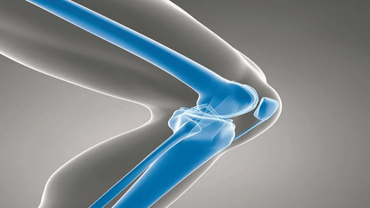 What is the Best Age for a Knee Replacement?