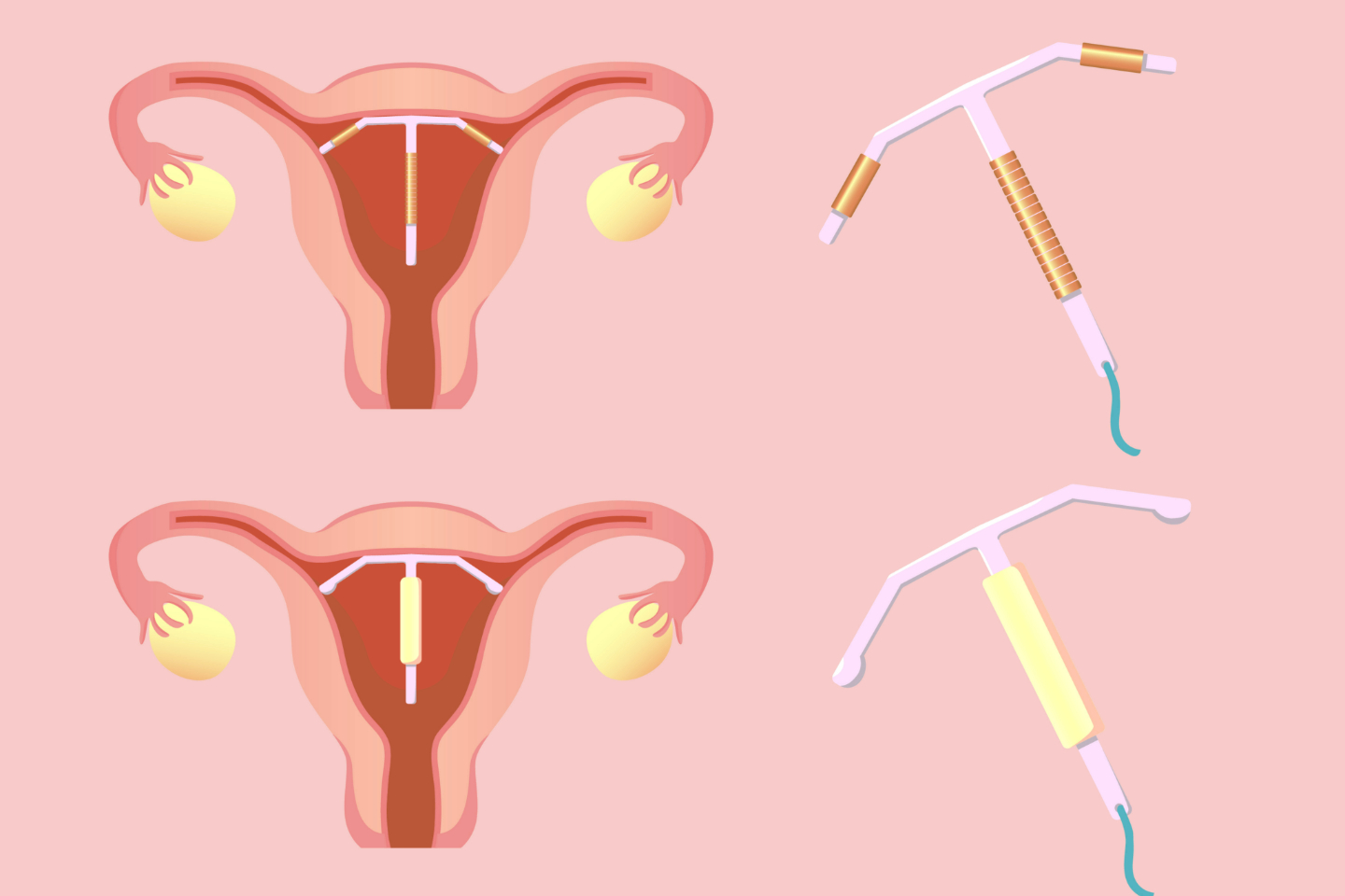 Hormonal and Copper