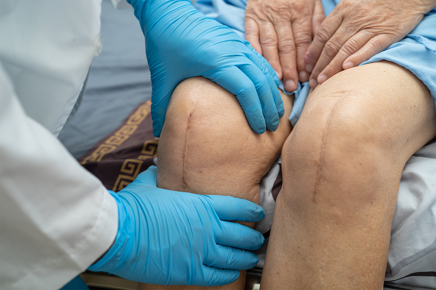 How to Care for your Knee Incision Post-Surgery?