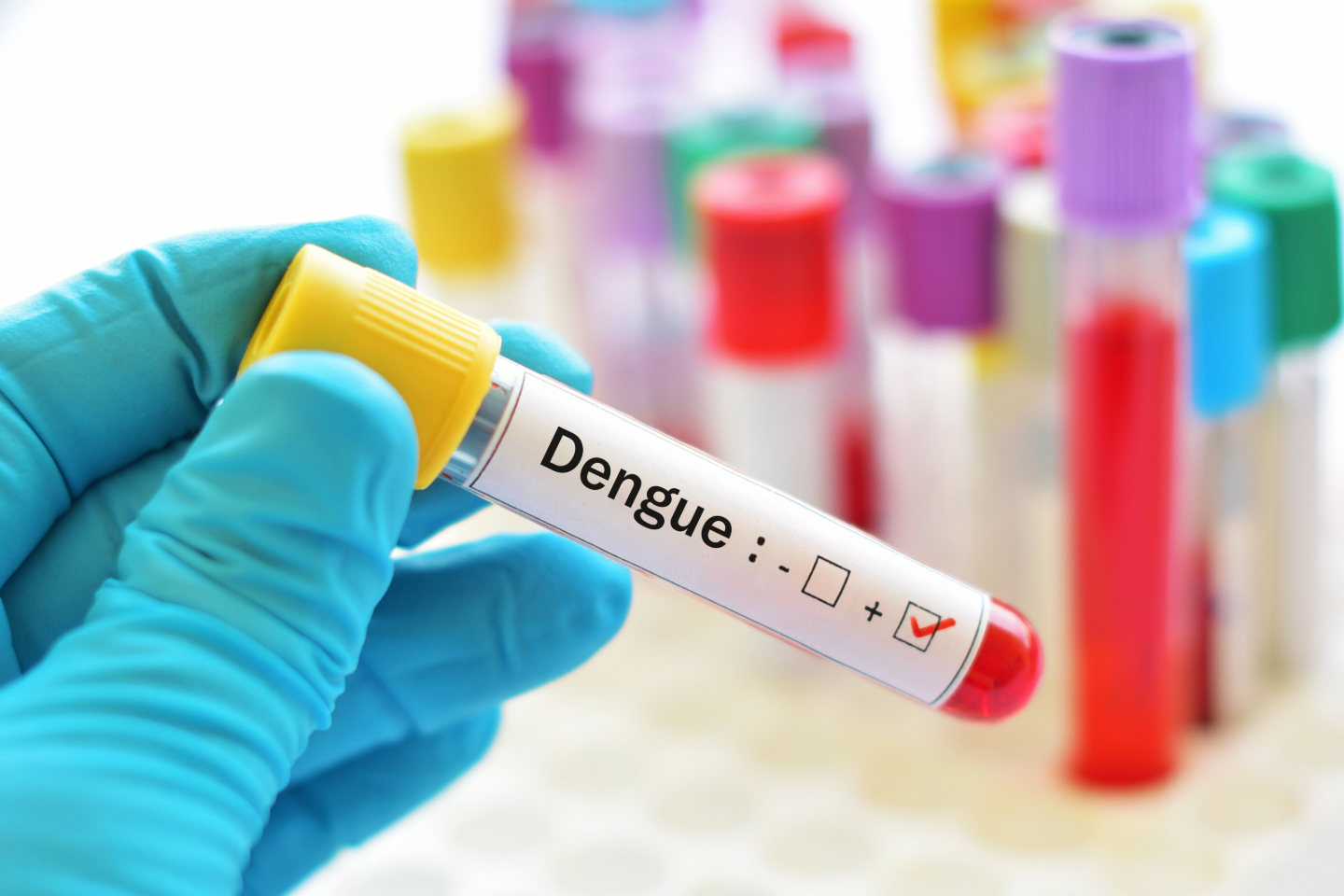 Dengue Fever: Causes, Symptoms and Treatment