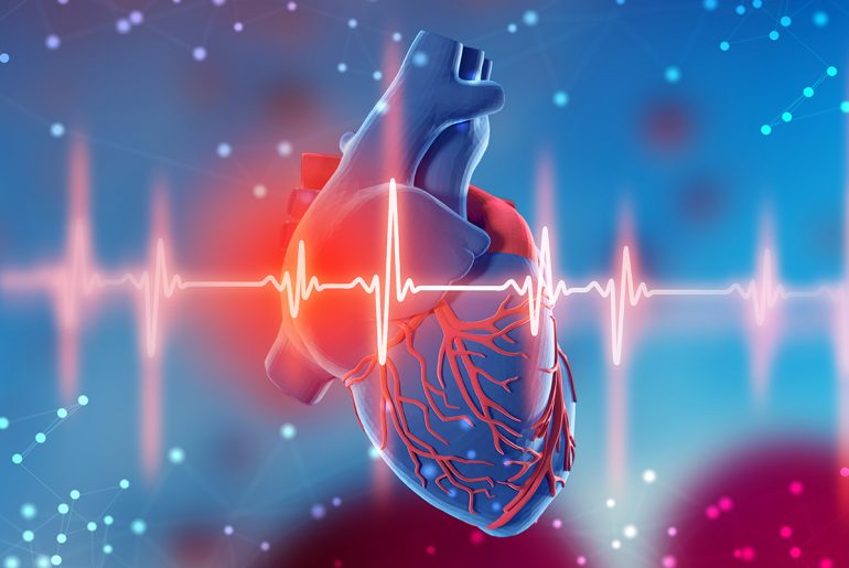 cardiovascular disease images