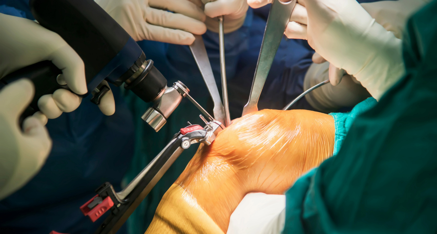 Patient Outcomes: Traditional vs. Robotic Knee Replacements